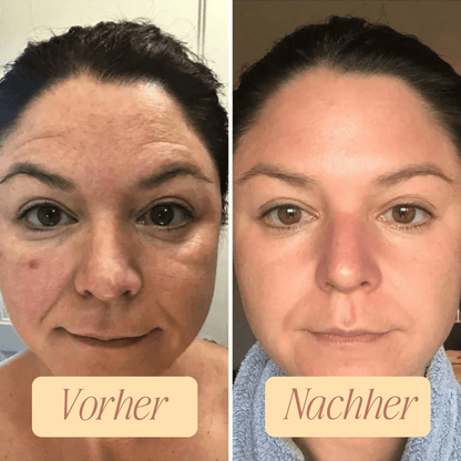 Kollagen Boosting Maske